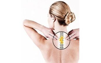 αυχενική οστεοχόνδρωση σε μια γυναίκα